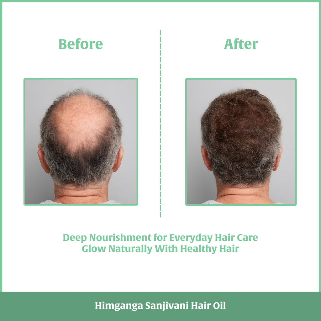 Sanjivani Hair Oil