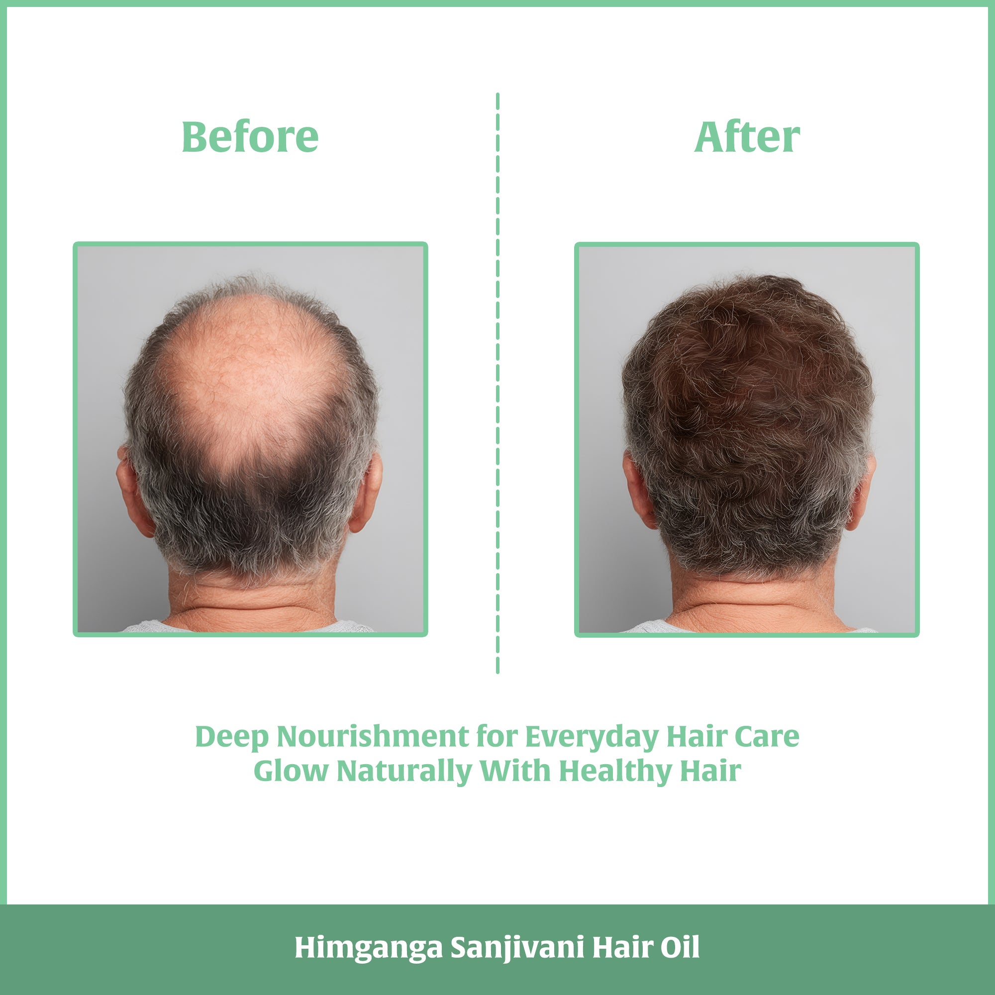 Sanjivani Hair Oil